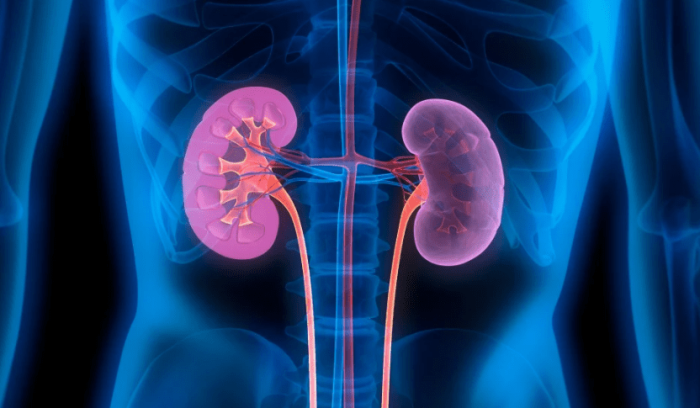 腎結石症狀腰痛