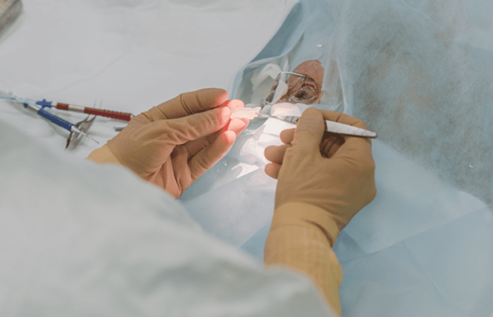 牙結石手術費用