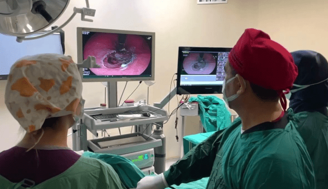 扁桃腺結石手術費用