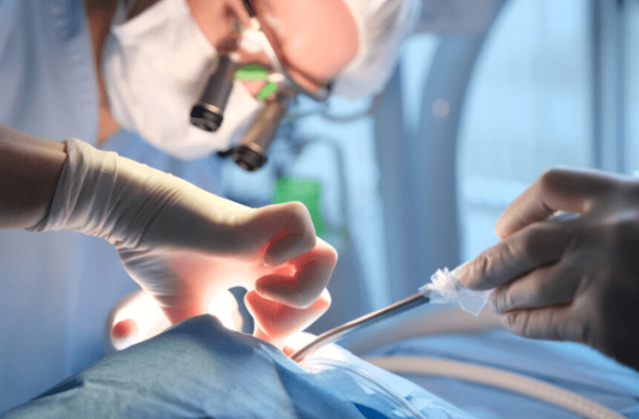 牙結石手術後遺症