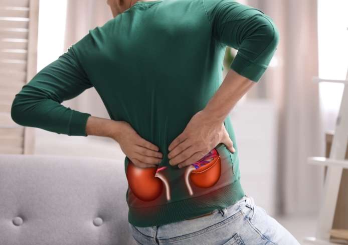 腎結石治療方法