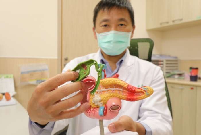  膽結石治療方法