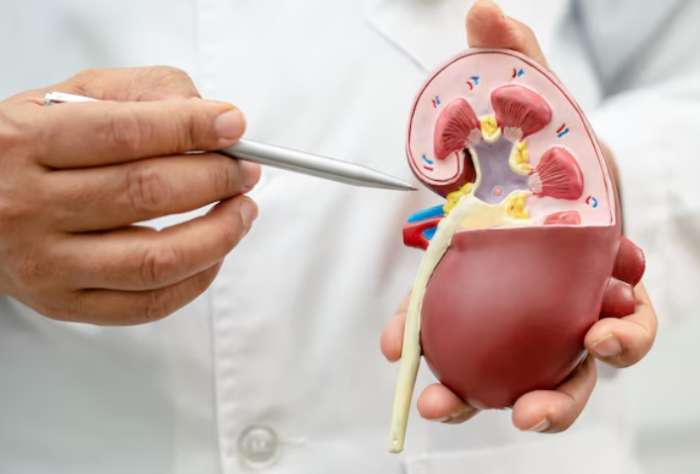 腎結石會自己好嗎