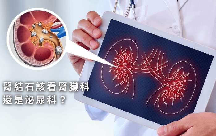 腎結石治療